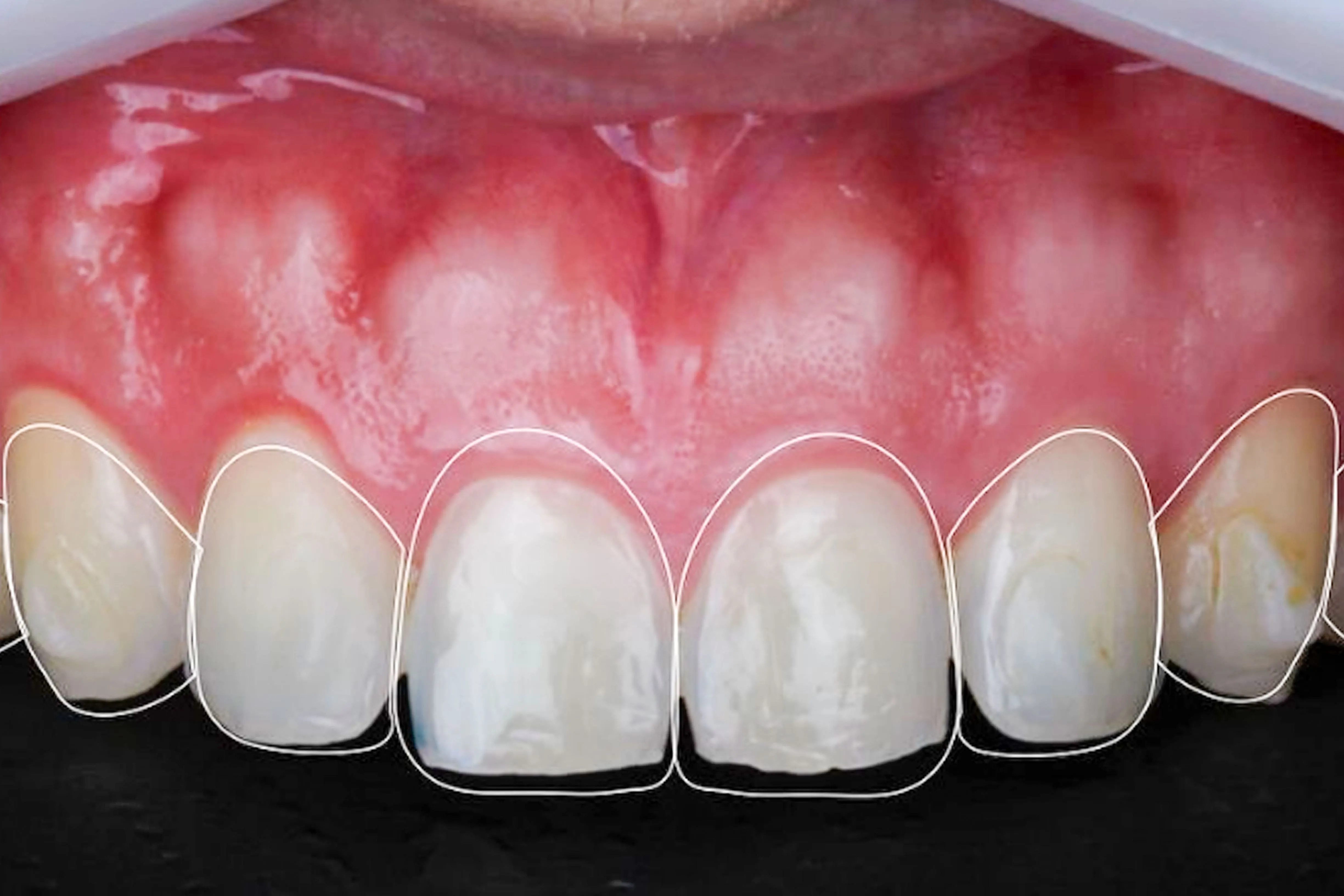 Estética do sorriso